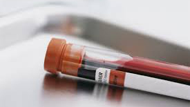 Blood sample in a sealed test tube.